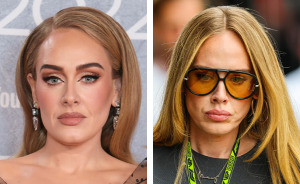 Plastic Surgeon Intervenes After Adele's Appearance At Rare Public Outing Turns Into Viral Discussion