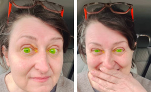 Woman Horrified After Her Pupils Turn Fluorescent Green During Routine Eye Exam, Experts Explain What Happened