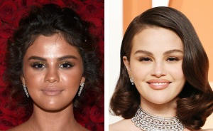 Doctor Exclusively Reveals Dangers Of New Beauty Trend Taking The Internet By Storm