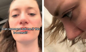 Woman Asks For Help After Noticing Bizarre Issue When Bending Over, Many Desperately Respond