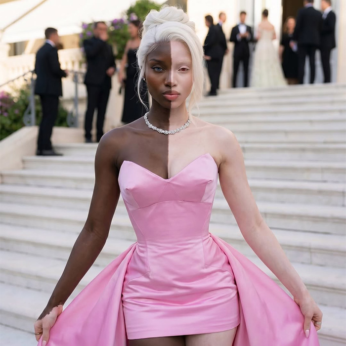 An unrecognizable former Netflix star in a striking pink dress, with half her body dark-skinned and half light-skinned, at a World Cup event. An unrecognizable former Netflix star in a striking pink dress, with half her body dark-skinned and half light-skinned, at a World Cup event.