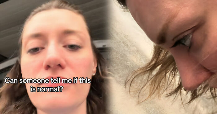 Woman Asks For Help After Noticing Bizarre Issue When Bending Over, Many Desperately Respond