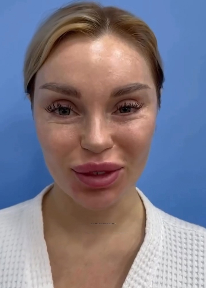 Woman’s Post-Plastic Surgery Photos Divide The Internet As She And Her Surgeon Celebrate The Results