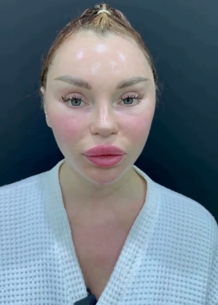 Woman’s Post-Plastic Surgery Photos Divide The Internet As She And Her Surgeon Celebrate The Results
