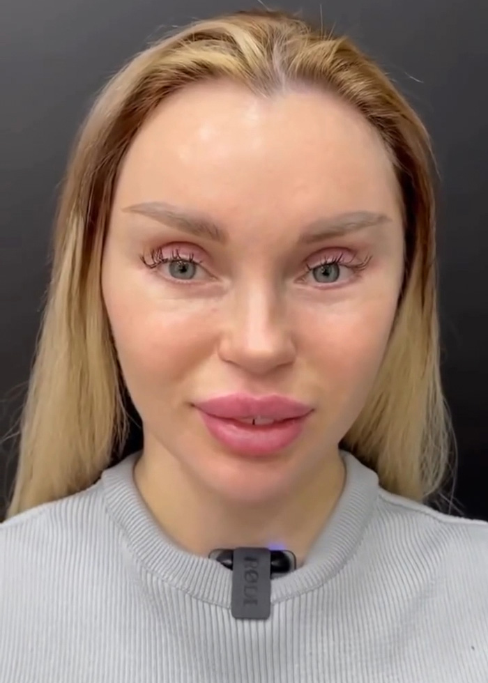 Woman’s Post-Plastic Surgery Photos Divide The Internet As She And Her Surgeon Celebrate The Results