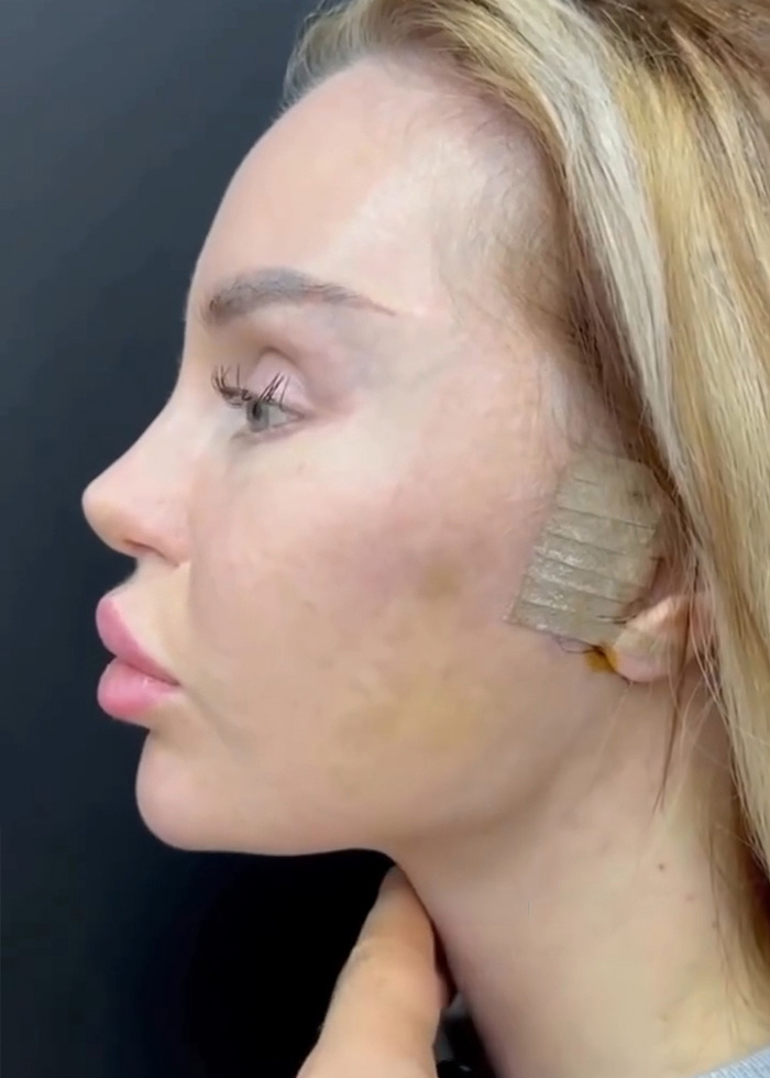 Woman’s Post-Plastic Surgery Photos Divide The Internet As She And Her Surgeon Celebrate The Results