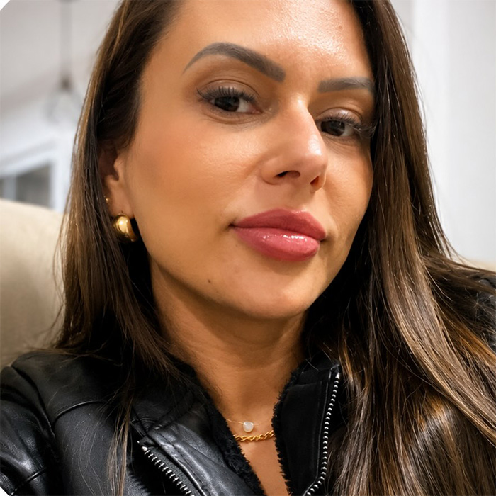 A woman with natural-looking lips, before a cosmetic procedure that later dramatically changed her face. A woman with natural-looking lips, before a cosmetic procedure that later dramatically changed her face.