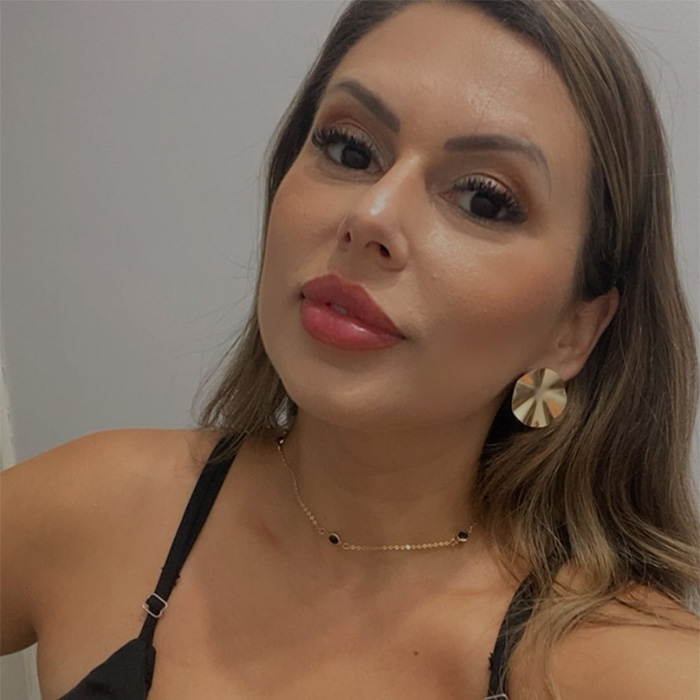 A woman with dramatic facial changes after a cosmetic procedure, highlighting the risks. A woman with dramatic facial changes after a cosmetic procedure, highlighting the risks.
