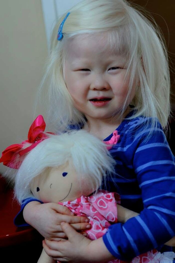 This Woman Continues To Create Custom Dolls That Celebrate Every Child’s Uniqueness (25 New Pics)