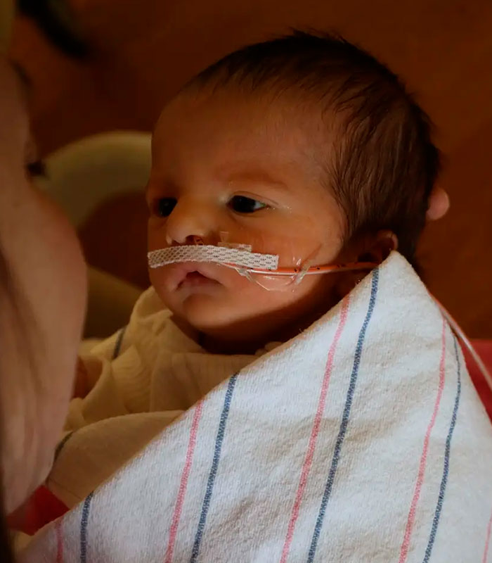 Mom Knew Something Was Wrong When Her Baby Couldn’t Form Expressions, Then Doctors Discovered A Rare Condition Mom Knew Something Was Wrong When Her Baby Couldn’t Form Expressions, Then Doctors Discovered A Rare Condition
