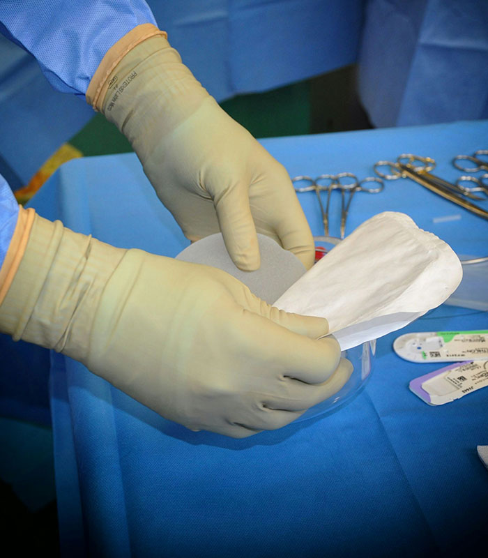 A surgeon wearing gloves prepares breast implants for plastic surgery, highlighting the potential consequences of illegal procedures. A surgeon wearing gloves prepares breast implants for plastic surgery, highlighting the potential consequences of illegal procedures.