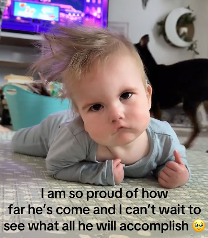 Mom Knew Something Was Wrong When Her Baby Couldn’t Form Expressions, Then Doctors Discovered A Rare Condition Mom Knew Something Was Wrong When Her Baby Couldn’t Form Expressions, Then Doctors Discovered A Rare Condition