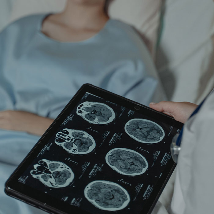 A doctor showing brain scan images on a tablet to a patient, illustrating the early detection of cancer symptoms. A doctor showing brain scan images on a tablet to a patient, illustrating the early detection of cancer symptoms.