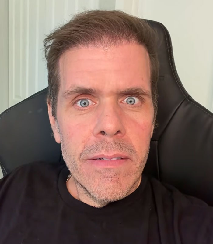 Perez Hilton, wide-eyed, after a disturbing livestream; new details emerge about his recovery. Perez Hilton, wide-eyed, after a disturbing livestream; new details emerge about his recovery.