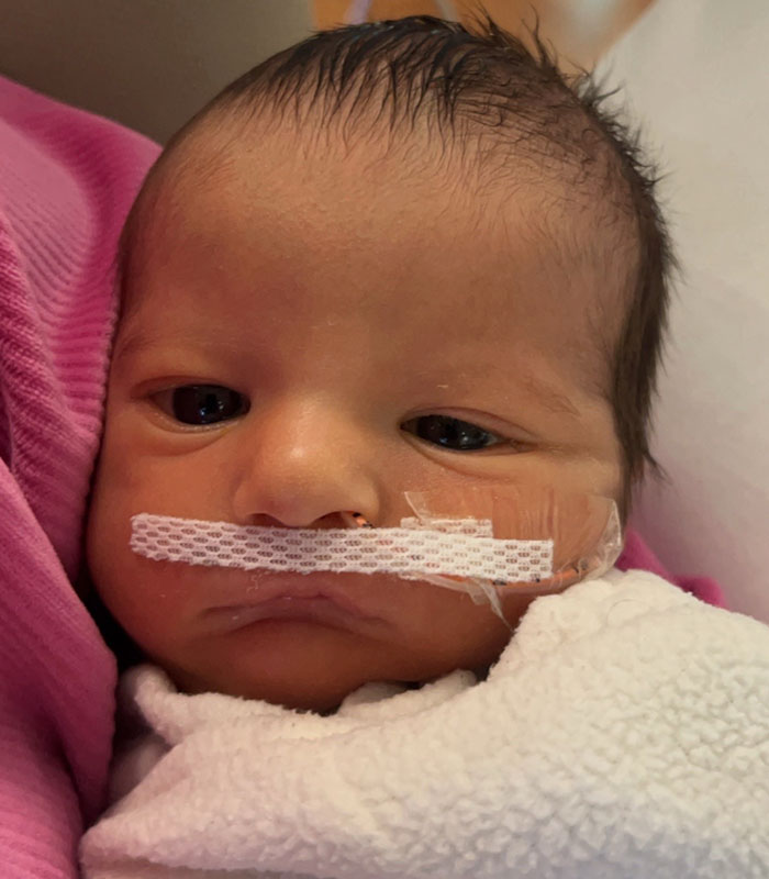 Mom Knew Something Was Wrong When Her Baby Couldn’t Form Expressions, Then Doctors Discovered A Rare Condition Mom Knew Something Was Wrong When Her Baby Couldn’t Form Expressions, Then Doctors Discovered A Rare Condition
