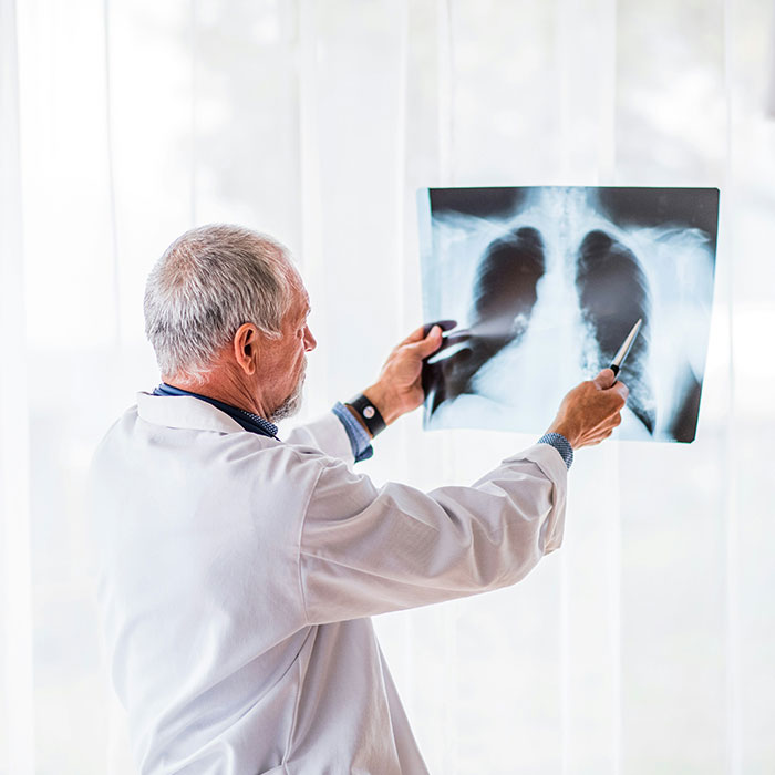Doctor pointing at an X-ray, examining for cancer symptoms and providing medical insight. Doctor pointing at an X-ray, examining for cancer symptoms and providing medical insight.