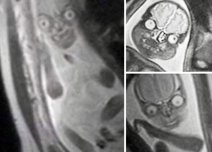 Wild pictures: A medical image of a fetus, appearing somewhat distorted and unusual, highlighting the weird and wonderful world.