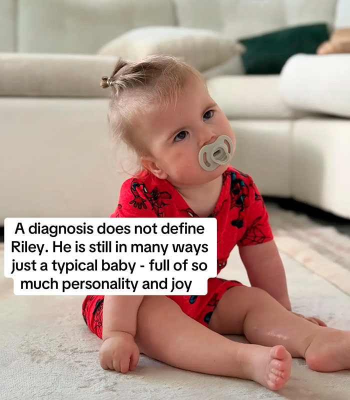 Mom Knew Something Was Wrong When Her Baby Couldn’t Form Expressions, Then Doctors Discovered A Rare Condition Mom Knew Something Was Wrong When Her Baby Couldn’t Form Expressions, Then Doctors Discovered A Rare Condition