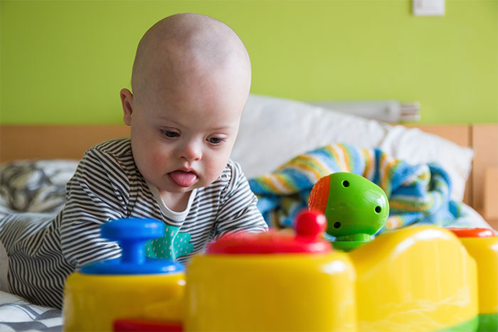 A baby with Down syndrome, wearing a striped onesie, plays with a colorful toy train on a bed.