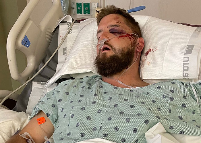 A seriously injured groom in a hospital bed after the wedding day tragedy caused by a drunk woman. A seriously injured groom in a hospital bed after the wedding day tragedy caused by a drunk woman.