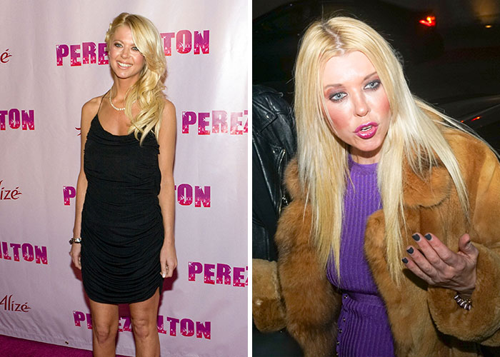 Female star Tara Reid targeted by celebrity blogger, her mental breakdown shocked the world.
