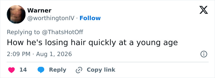 Tweet by Warner mentioning a Hollywood star losing hair quickly at a young age. Tweet by Warner mentioning a Hollywood star losing hair quickly at a young age.