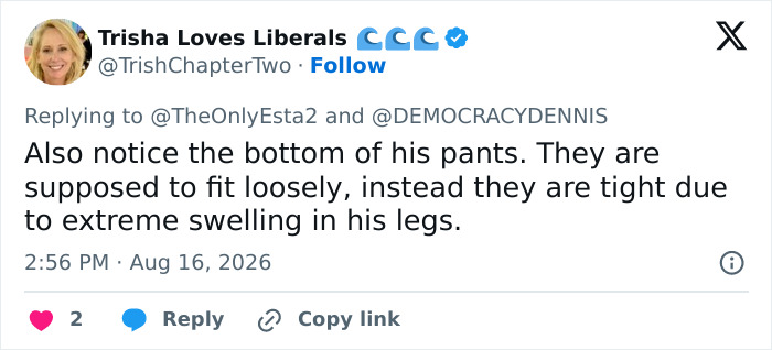 Trump’s “Mystery Bulge” Leads To Frenzied Reactions As Many Speculate What Could Be In His Pants Trump’s “Mystery Bulge” Leads To Frenzied Reactions As Many Speculate What Could Be In His Pants