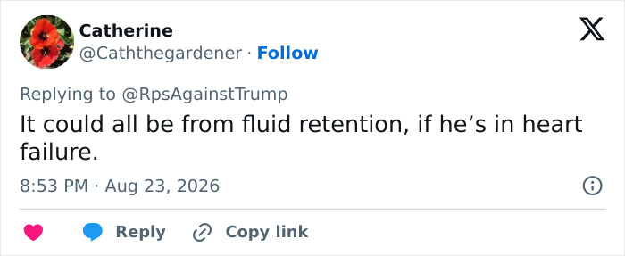 A Twitter comment by Catherine suggests fluid retention for Donald Trump's health marker, possibly heart failure. A Twitter comment by Catherine suggests fluid retention for Donald Trump's health marker, possibly heart failure.
