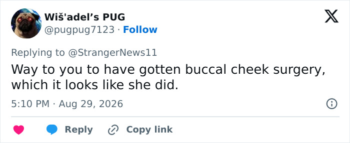 A social media comment about Millie Bobby Brown possibly having buccal cheek surgery, facing scrutiny. A social media comment about Millie Bobby Brown possibly having buccal cheek surgery, facing scrutiny.