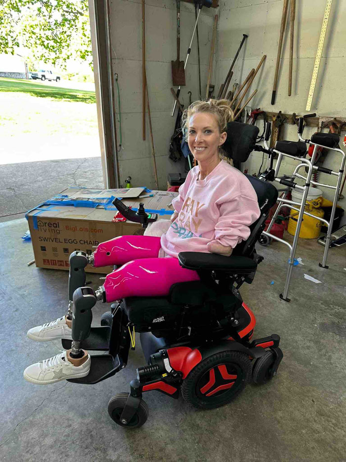 A woman who had both legs and hands amputated after surgery sits in a motorized wheelchair with prosthetic legs. A woman who had both legs and hands amputated after surgery sits in a motorized wheelchair with prosthetic legs.