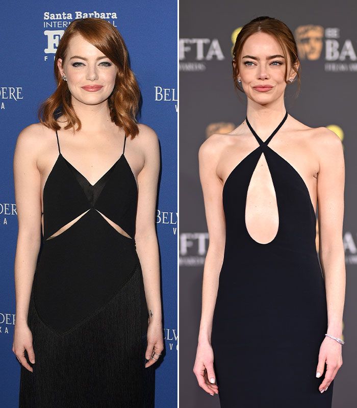 Emma Stone, a celebrity woman, presents a change in weight, causing fan concern regarding health risks.