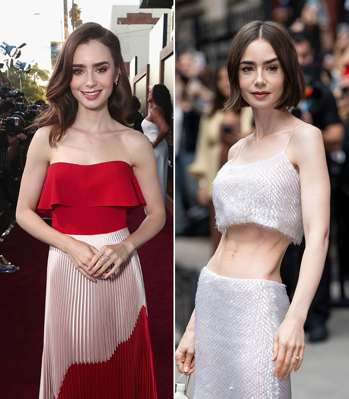 Lily Collins, a celebrity woman, shows a significant weight difference, raising concerns about her health and doctor-revealed risks.
