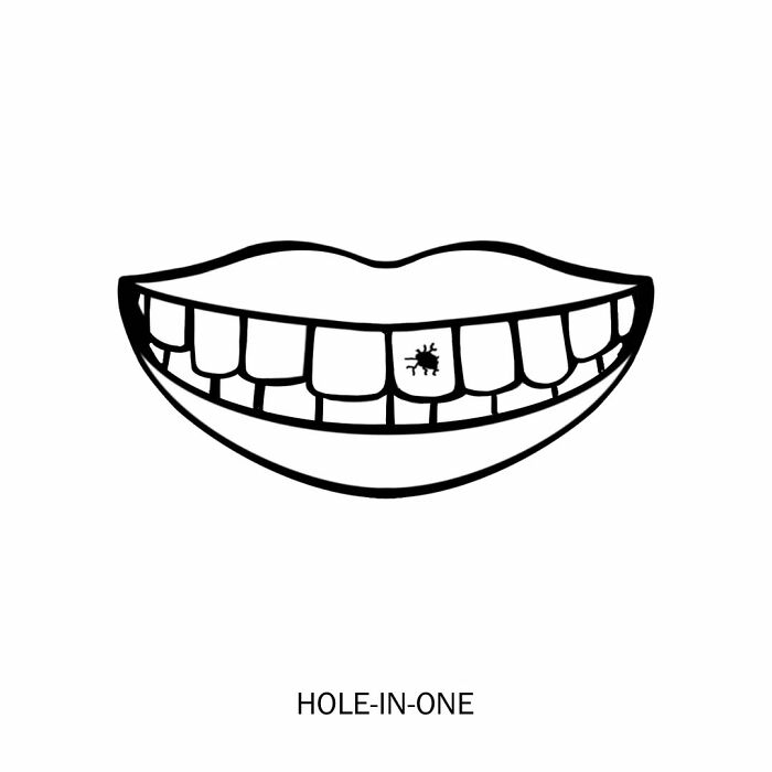 Humorous illustration of a hole-in-one, a golf ball in a tooth, redefining words.