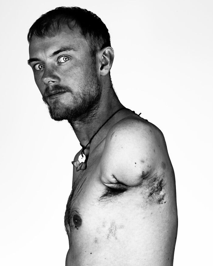 A black and white portrait by Brock Elbank of a man with an amputated arm, revealing the stories behind the faces.