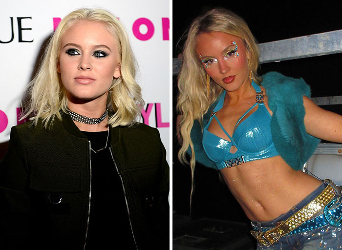 Zara Larsson's before and after fame style transformation, highlighting her celebrity looks.