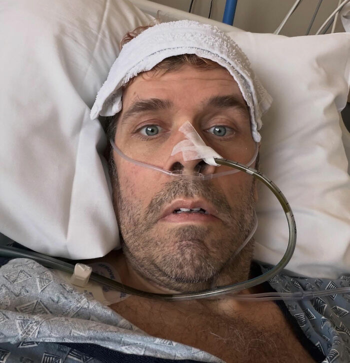 Perez Hilton in hospital bed with an IV and oxygen tubes, looking ill after the horrifying livestream reveal. Perez Hilton in hospital bed with an IV and oxygen tubes, looking ill after the horrifying livestream reveal.