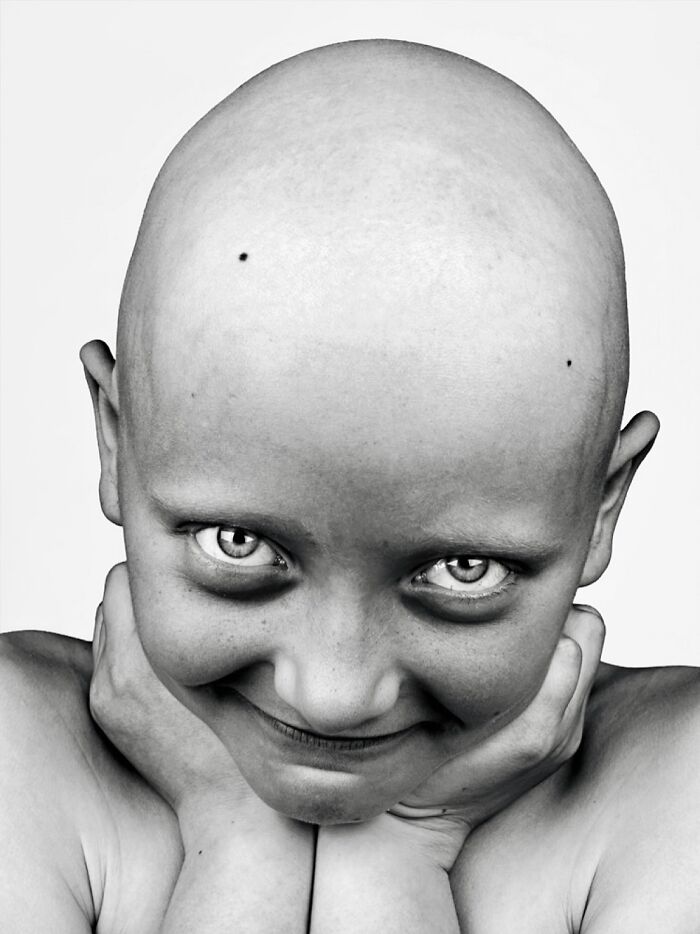 A black and white portrait by Brock Elbank of a smiling bald child, focusing on the compelling stories behind faces.