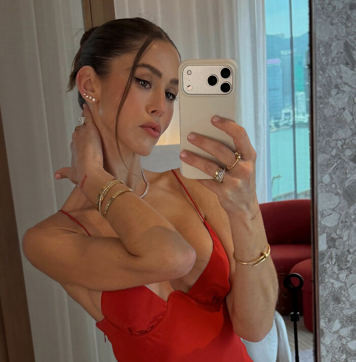 How Young Is Too Young To Get A Korean Facelift? Netizens Criticize Influencer's Decision After Recovery Posts How Young Is Too Young To Get A Korean Facelift? Netizens Criticize Influencer's Decision After Recovery Posts