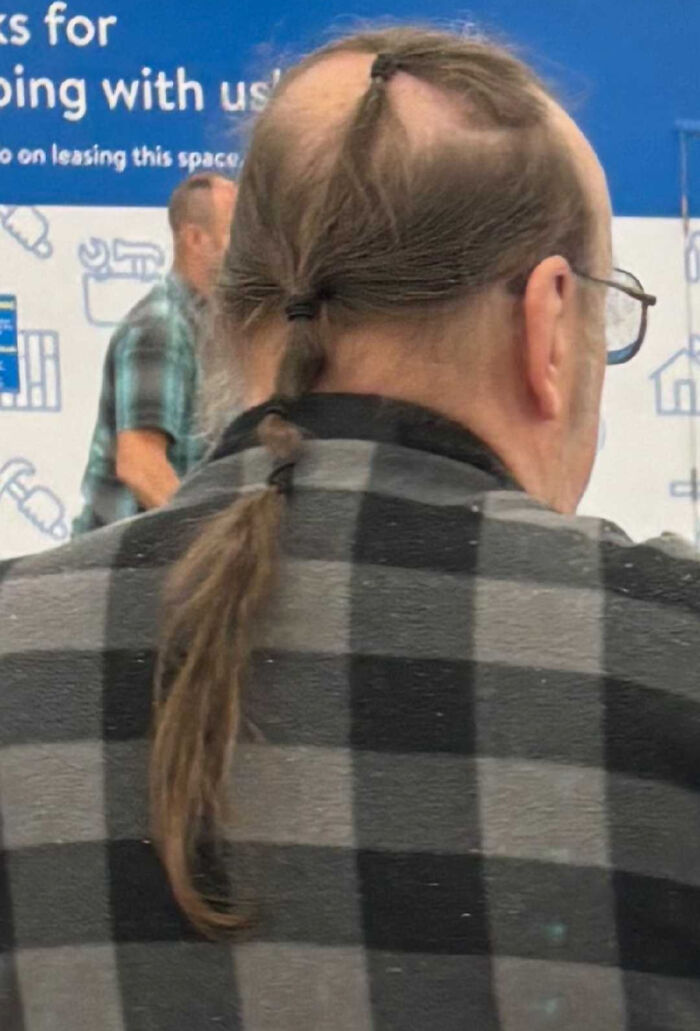 A person from behind with a bold, partially bald hairstyle featuring multiple small ponytails and a long braid.