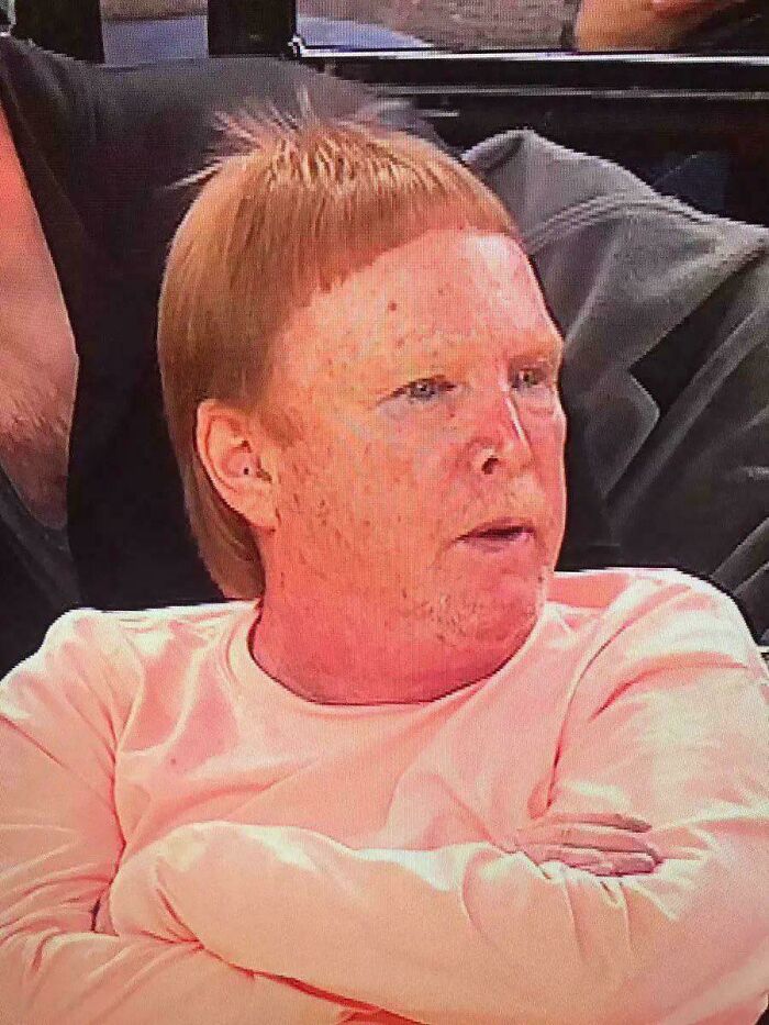 A man with red hair in a short, uneven bowl cut, showcasing a bold hairstyle.