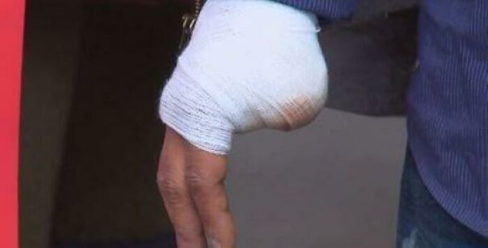 A person with a bandaged arm, appearing like an unusual leg, making it one of the confusing pics.