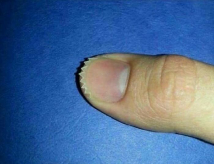 A close-up of a thumb with a zigzag-cut fingernail, showing a strange detail that people cannot explain.