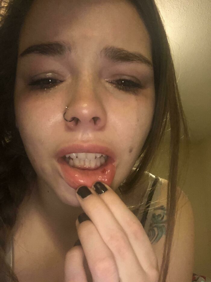 A young woman with tears in her eyes pulls down her lower lip, revealing a cut on the inside. Parents will relate.