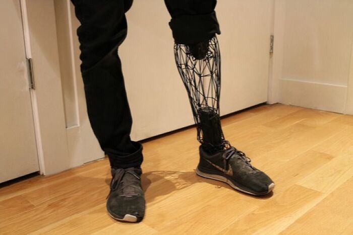 A person standing with a custom 3D printed prosthetic leg, showcasing its intricate cage-like design.