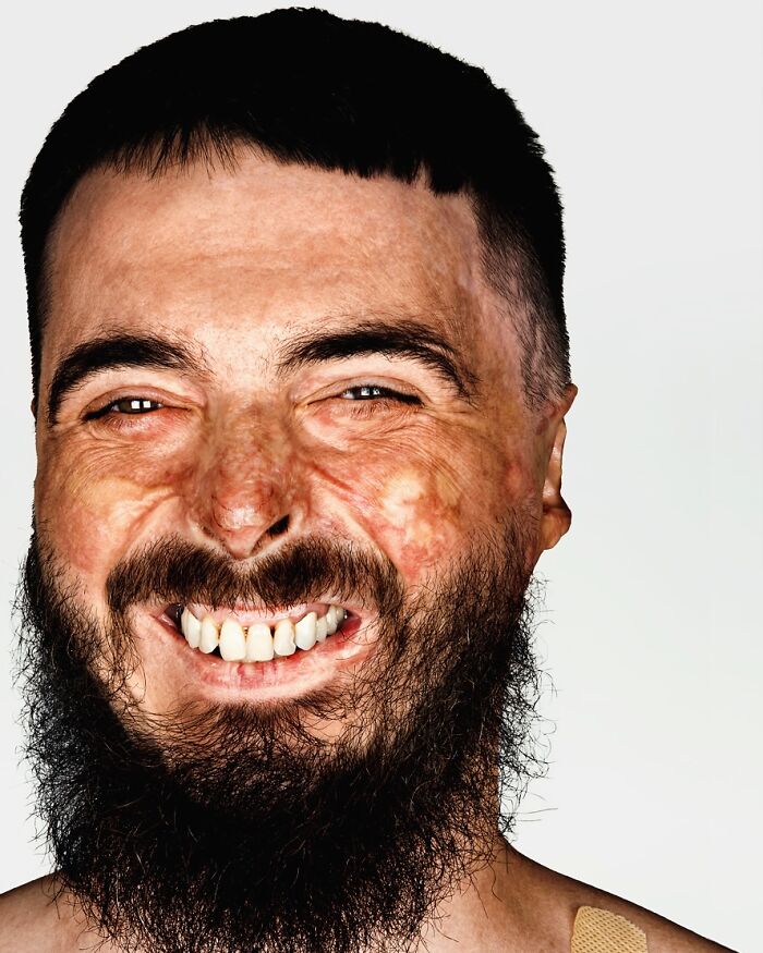 A close-up portrait by Brock Elbank showing a man with a beard, smiling widely, with unique facial features.