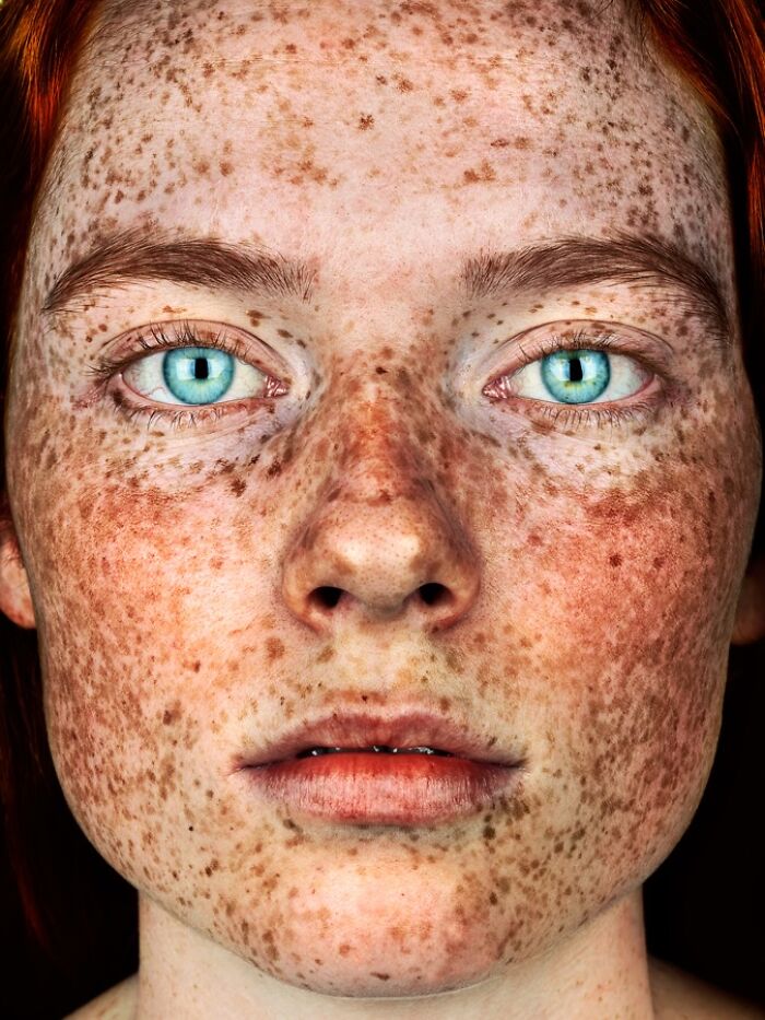 A close-up portrait by Brock Elbank featuring a person with vibrant blue eyes and a face densely covered in freckles.