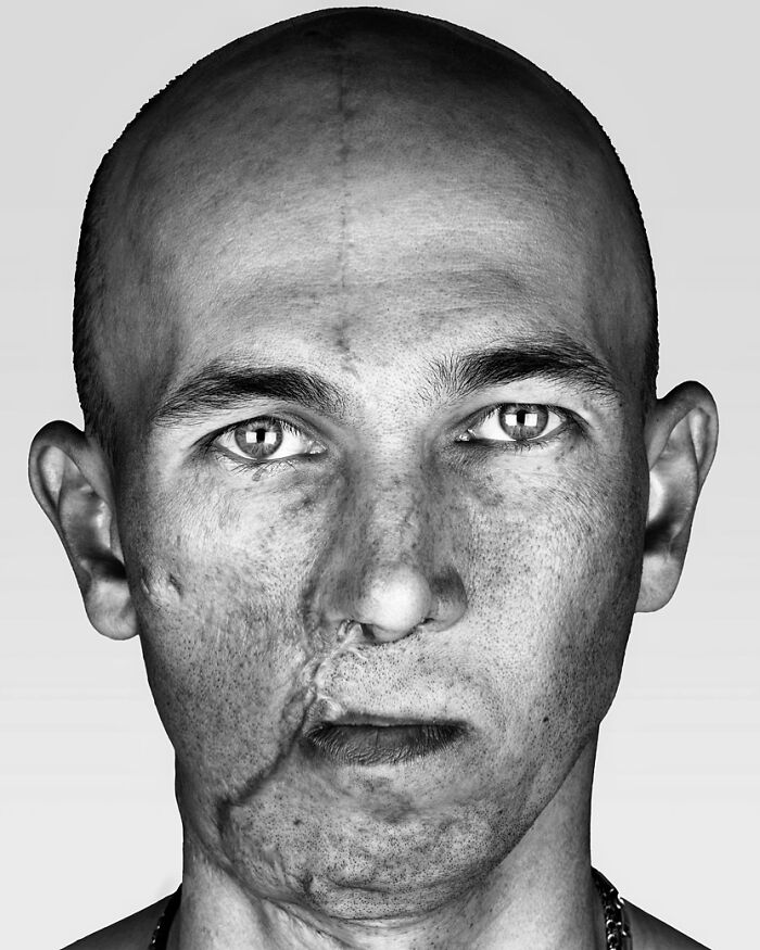A stark black and white portrait by Brock Elbank of a man with a shaved head and a prominent scar on his face, looking directly at the viewer.