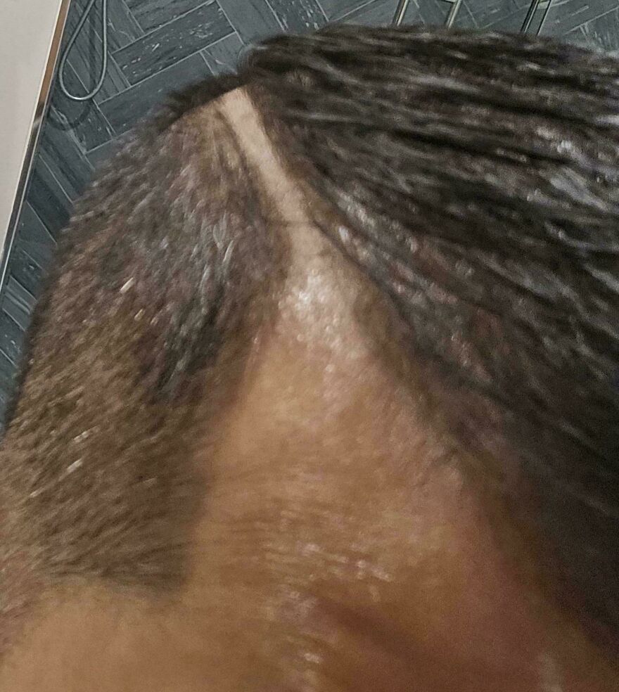 A person with a large strip of hair shaved down the middle of their head, a funny unfortunate hair fail.