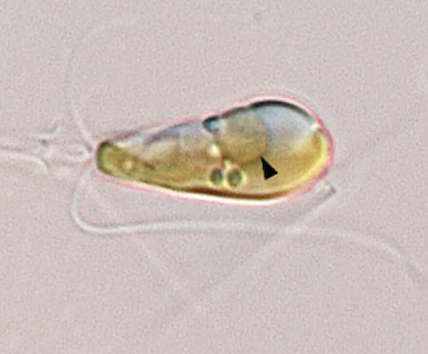 Microscopic image of a single-celled organism, a strange thing happening on Earth that looks incredible.