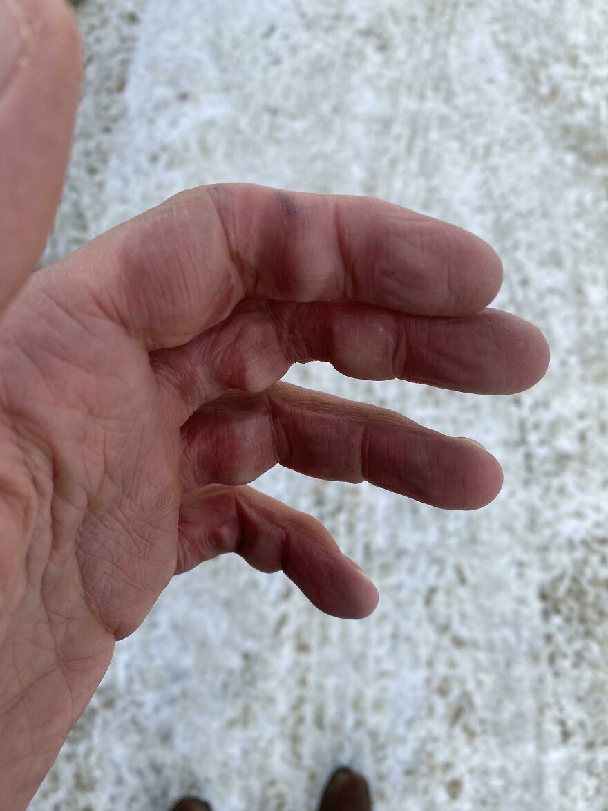An unfortunate regret of a hand with marker stains, showing ink on fingers against a white background.